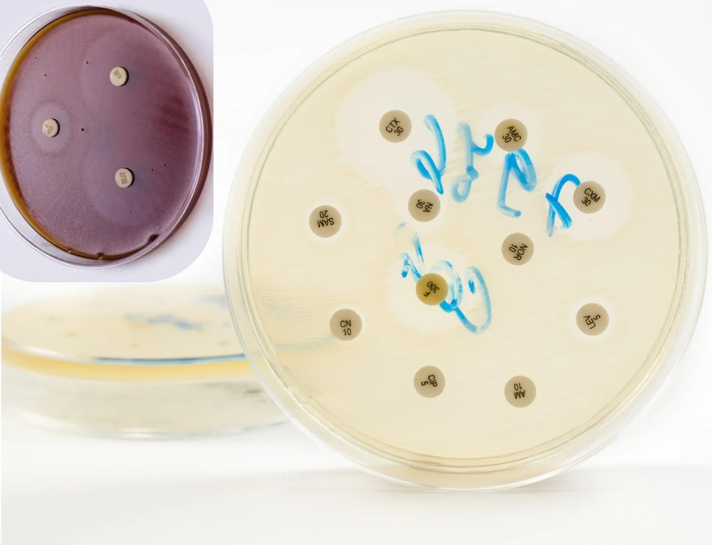Investigación & Desarrollo: Dosis Letal para erradicar Patógenos